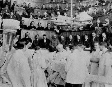 Popular Science: When surgery was a public spectacle